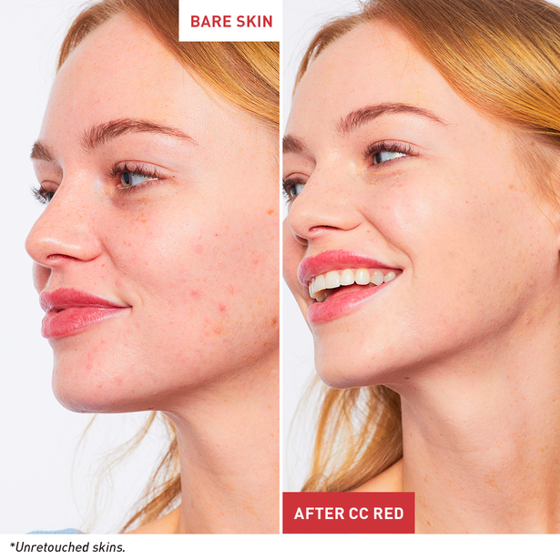 CC Red Correct: say bye to redness